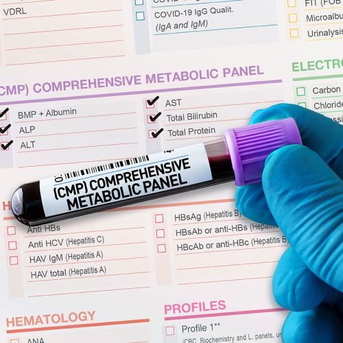 Advanced Metabolic Panels Image