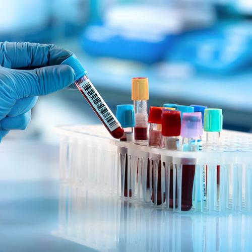 Hormone Panels (Estradiol, Progesterone, Testosterone, DHEA, SHBG) Image