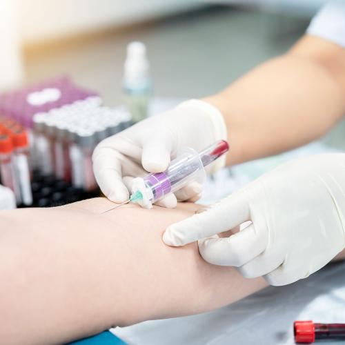 Inflammatory Markers (hsCRP, Ferritin, Homocysteine) Image