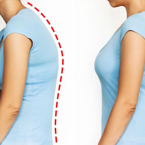 Posture, Gait, and Biomechanical Analysis Image